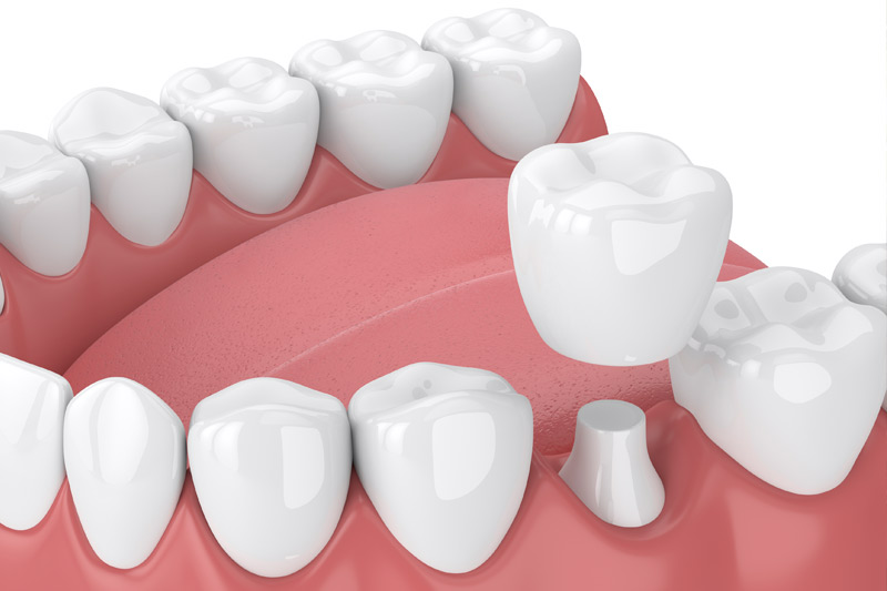 Quality Dental Treatments in Anaheim