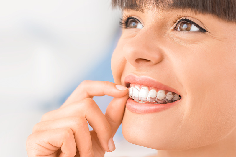 Quality Dental Treatments in Anaheim